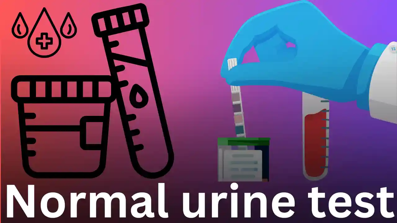 urine-test